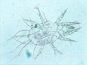 実はこんなところにも!?「ダニ」の種類について|(株)愛研|水質や土壌の汚染調査・作業環境測定を行う愛知県名古屋市の検査所